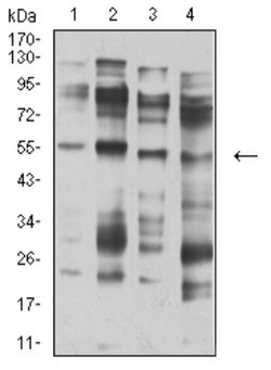 Nicotinic Acetylcholine R alpha 5/CHRNA5 Antibody (2D2D10) - BSA Free,